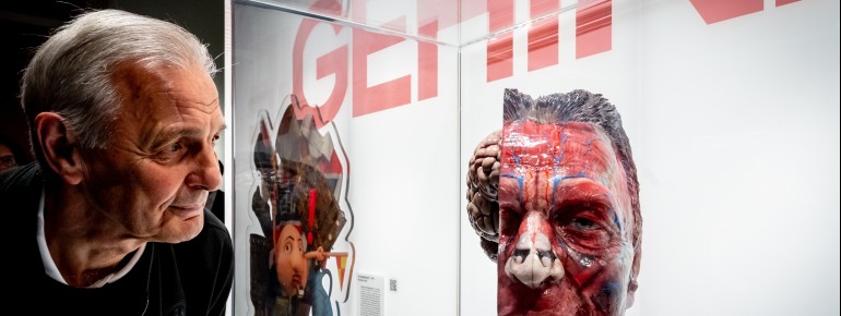 The brain of Bundesliga record-player and Eintracht Frankfurt legend Karl-Heinz "Charly" Körbel is on display in the permanent exhibition "Brains".